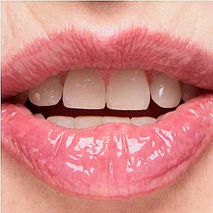 Lip Ointment Hydrating Lip Treatment